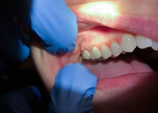 Best Emergency Dental Filling Replacement  in Greenville, DE